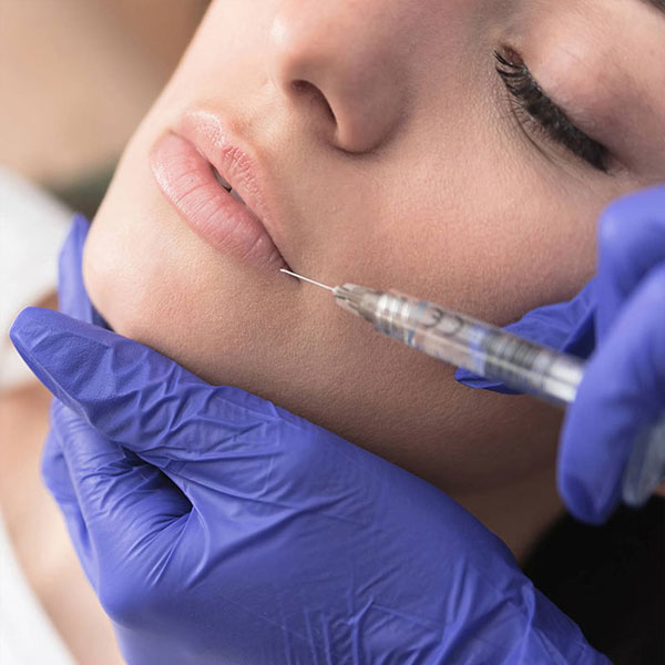 Dermal Fillers